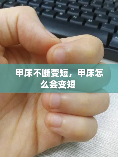甲床不断变短,甲床怎么会变短