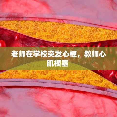 老师在学校突发心梗，教师心肌梗塞 